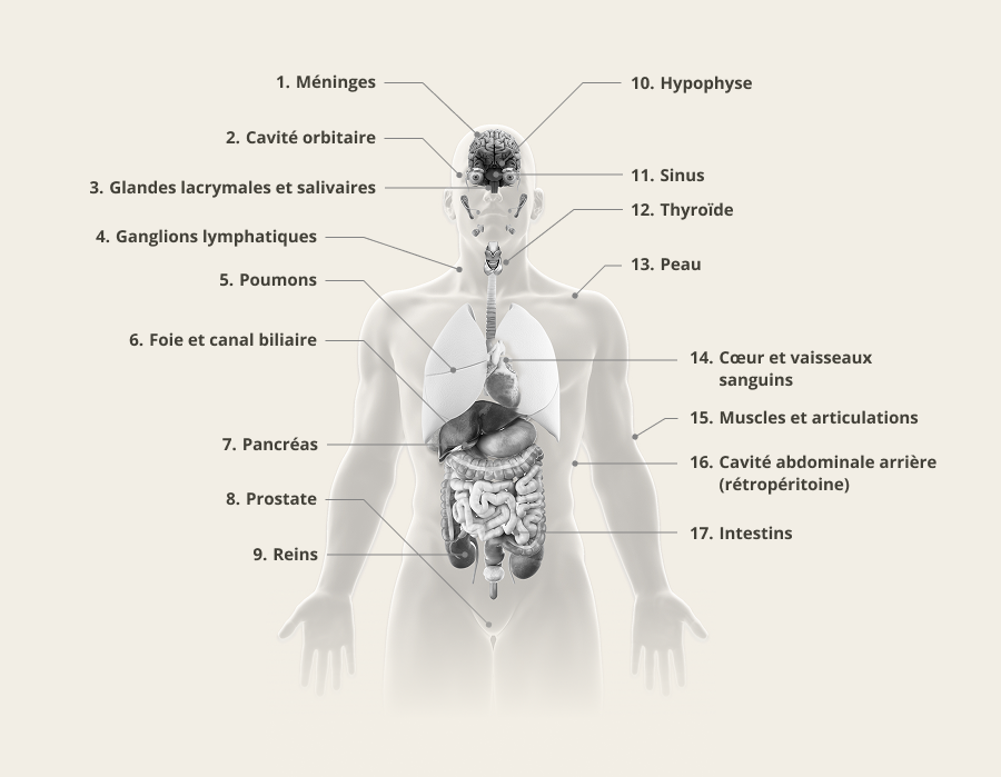 Symptômes de l’IgG4-RD propres aux organes