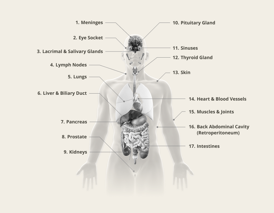 Organ-Specific Symptoms of IgG4-RD