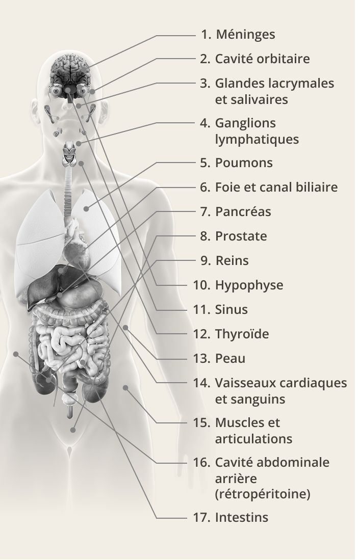 Symptômes de l’IgG4-RD propres aux organes